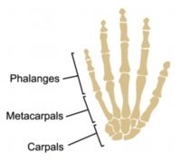 Hand and Wrist Pain Diagnosis Guide - Metacarpal Fracture Anatomy