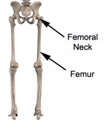 Relevant Anatomy for a Femoral Neck Fracture
