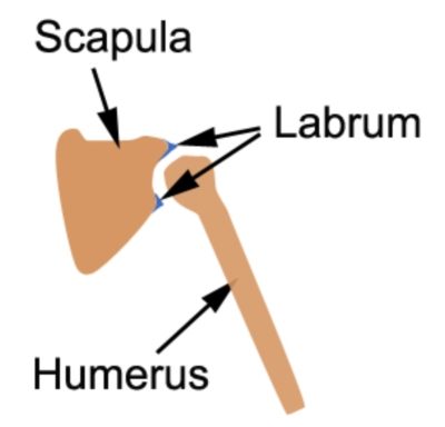 Labral Tear of the Shoulder