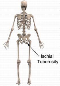 Thigh Injury Diagnosis - Ischial Tuberosity Anatomy