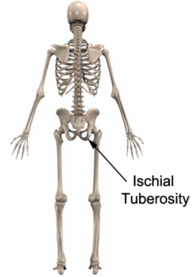 Relevant anatomy of ischiogluteal bursitis (ischial tuberosity)