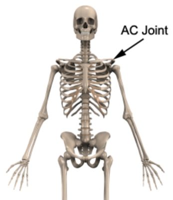 AC Joint Sprain Anatomy 