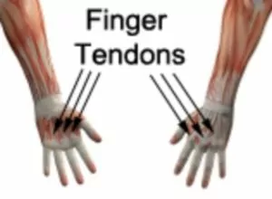 Hand and Wrist Pain Diagnosis Guide - Relevant Anatomy for a Finger Tendon Rupture