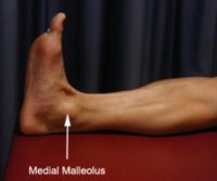 Ankle Diagnosis - Medial Malleolus Anatomy
