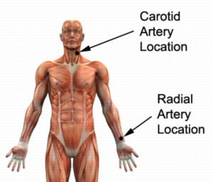 Cardiovascular Exercise Pulse Palpation (Carotid & Radial Arteries)