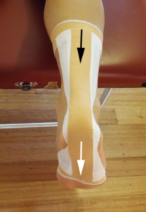 Achilles Tendon Taping - Straight Lines