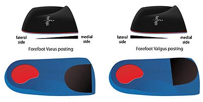 Footlogics orthotics Forefoot varus and valgus posting