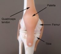Less Common Knee Injuries - Anatomy of a Patellofemoral Joint Injury