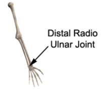 Hand and Wrist Pain Diagnosis Guide - Distal Radio Ulnar Joint