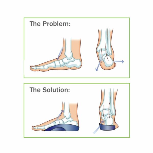 Talar Made Orthotics - 3/4 length orthotics - PhysioAdvisor